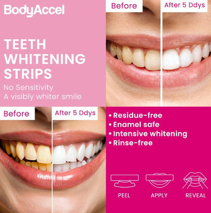 Teeth Whitening Strips
